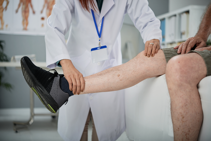 Varicose Vein Treatments